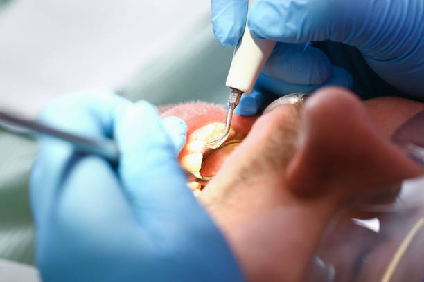 Best Emergency Gum Treatment in Orange Park, FL