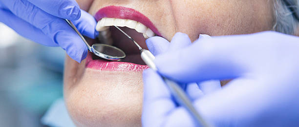 Best Emergency Root Canal Treatment in Orange Park, FL